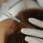 PRP Hair Treatment