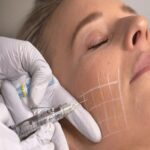 Skin Booster Treatment