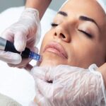 Skin Improvement Treatment