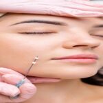 Thread Lifting Treatment